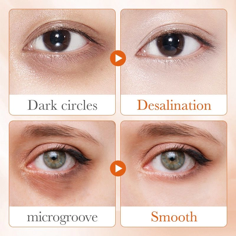 Sadoer Vitamin C Brightening Eye Cream 20g