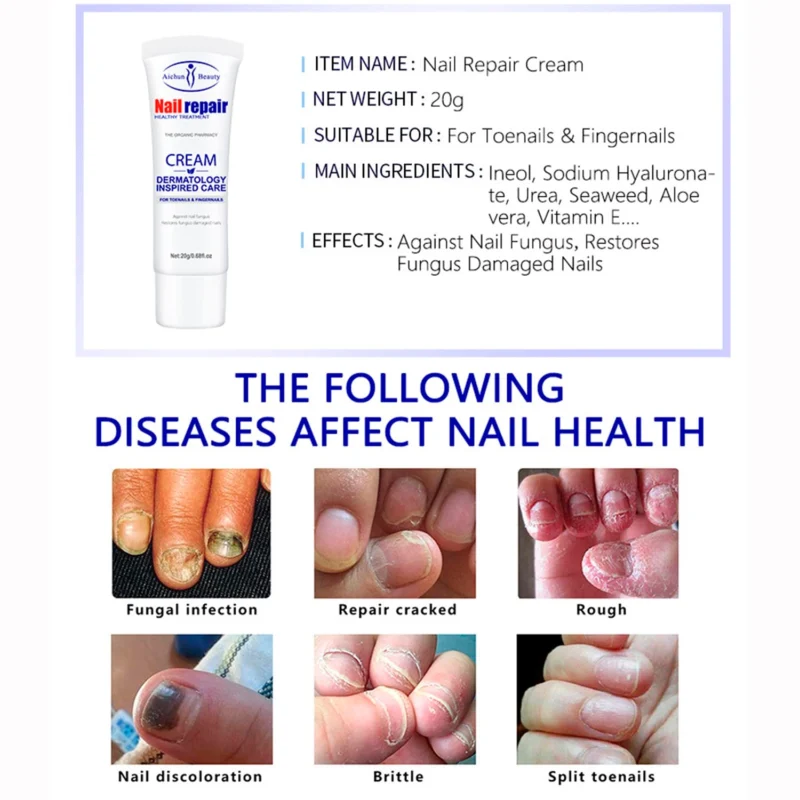 Aichun Beauty Nail Repair Cream Dermatology Inspired Care 20g